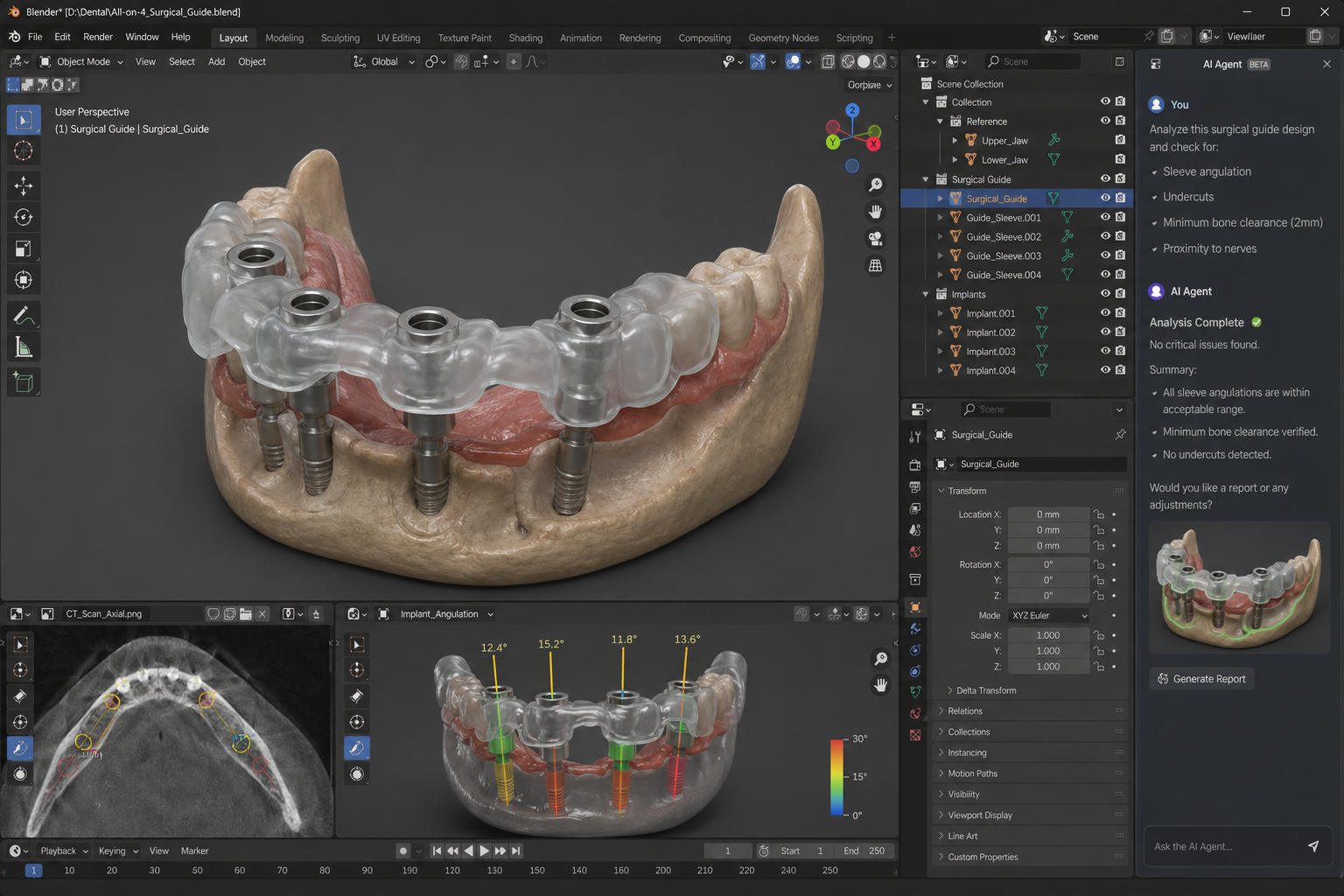 Blender и AI: Бъдещето на 3D дизайна в денталната медицина